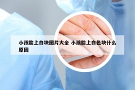 小孩脸上白块图片大全 小孩脸上白色块什么原因