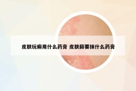 皮肤玩癣用什么药膏 皮肤藓要抹什么药膏