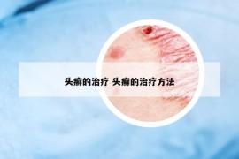 头癣的治疗 头癣的治疗方法