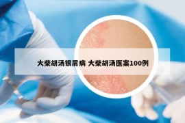 大柴胡汤银屑病 大柴胡汤医案100例