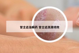 甘士达治癣药 甘士达洗液功效