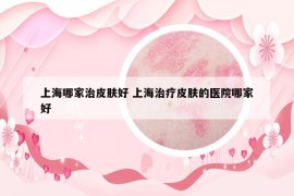 上海哪家治皮肤好 上海治疗皮肤的医院哪家好
