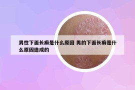 男性下面长癣是什么原因 男的下面长癣是什么原因造成的