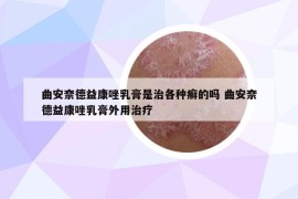 曲安奈德益康唑乳膏是治各种癣的吗 曲安奈德益康唑乳膏外用治疗