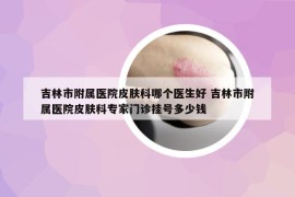 吉林市附属医院皮肤科哪个医生好 吉林市附属医院皮肤科专家门诊挂号多少钱