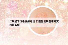 仁肤堂专注牛皮癣电话 仁医堂皮肤医学研究院怎么样