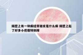 隔壁上有一块癣经常褪皮是什么癣 隔壁上起了好多小疙瘩特别痒