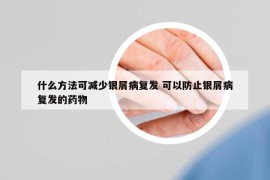 什么方法可减少银屑病复发 可以防止银屑病复发的药物