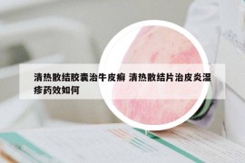 清热散结胶囊治牛皮癣 清热散结片治皮炎湿疹药效如何