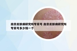 南京皮肤病研究所专家号 南京皮肤病研究所专家号多少钱一个