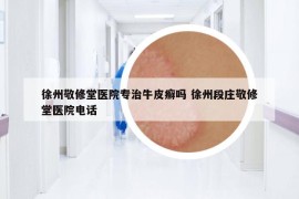 徐州敬修堂医院专治牛皮癣吗 徐州段庄敬修堂医院电话