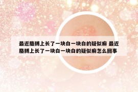 最近胳膊上长了一块白一块白的疑似癣 最近胳膊上长了一块白一块白的疑似癣怎么回事