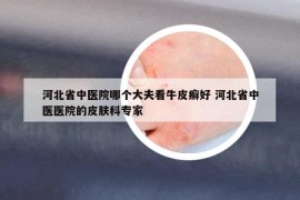 河北省中医院哪个大夫看牛皮癣好 河北省中医医院的皮肤科专家