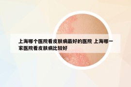 上海哪个医院看皮肤病最好的医院 上海哪一家医院看皮肤病比较好