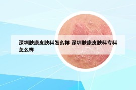 深圳肤康皮肤科怎么样 深圳肤康皮肤科专科怎么样