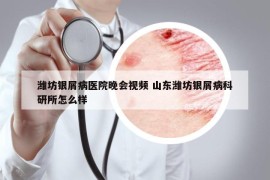 潍坊银屑病医院晚会视频 山东潍坊银屑病科研所怎么样