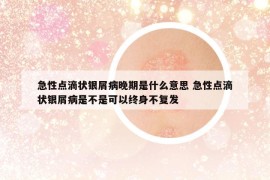 急性点滴状银屑病晚期是什么意思 急性点滴状银屑病是不是可以终身不复发