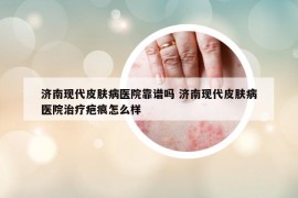 济南现代皮肤病医院靠谱吗 济南现代皮肤病医院治疗疤痕怎么样