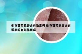 他克莫司软膏含有激素吗 他克莫司软膏含有激素吗有副作用吗