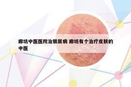 廊坊中医医院治银屑病 廊坊有个治疗皮肤的中医