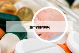 治疗早期白癜风