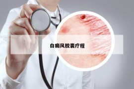 白癜风胶囊疗程