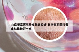 北京哪家医院看皮肤比较好 北京哪家医院看皮肤比较好一点