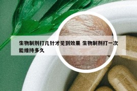 生物制剂打几针才见到效果 生物制剂打一次能维持多久