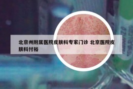 北京州附属医院皮肤科专家门诊 北京医院皮肤科付裕