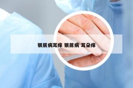 银屑病耳痒 银屑病 耳朵痒