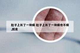 肚子上长了一块癣 肚子上长了一块癣也不痒,脱皮