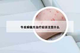 牛皮癣偏方治疗应该注意什么