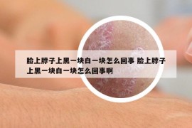 脸上脖子上黑一块白一块怎么回事 脸上脖子上黑一块白一块怎么回事啊