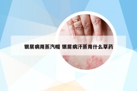 银屑病用蒸汽帽 银屑病汗蒸用什么草药