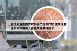 重庆儿童医院皮肤科哪个医生好些 重庆儿童医科大学附属儿童医院皮肤科挂号