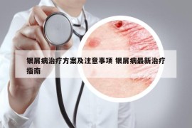 银屑病治疗方案及注意事项 银屑病最新治疗指南