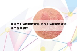 长沙市儿童医院皮肤科 长沙儿童医院皮肤科哪个医生最好