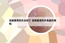 百癣夏塔热片太好了 百癣夏塔热片有副作用吗