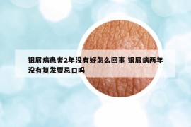 银屑病患者2年没有好怎么回事 银屑病两年没有复发要忌口吗