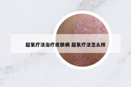 超氧疗法治疗皮肤病 超氧疗法怎么样