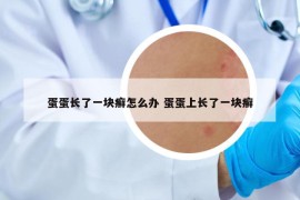 蛋蛋长了一块癣怎么办 蛋蛋上长了一块癣