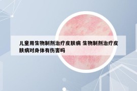 儿童用生物制剂治疗皮肤病 生物制剂治疗皮肤病对身体有伤害吗