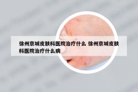 徐州京城皮肤科医院治疗什么 徐州京城皮肤科医院治疗什么病