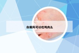 白癜风可以吃鸡肉么