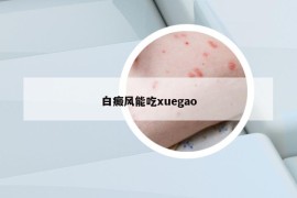 白癜风能吃xuegao