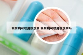 银屑病可以用氨溴索 银屑病可以用氨溴索吗