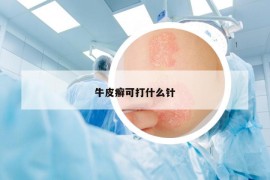 牛皮癣可打什么针