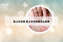 脸上长白斑 脸上长白斑是怎么回事