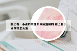 脸上有一小点白斑什么原因造成的 脸上有小点白斑怎么治