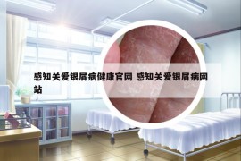 感知关爱银屑病健康官网 感知关爱银屑病网站